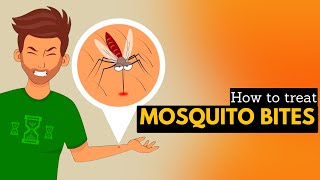 How To Treat Mosquito Bites [upl. by Iaras839]