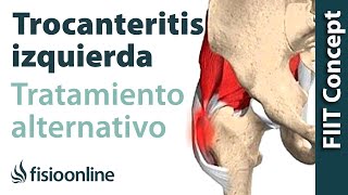 Trocanteritis izquierda  Visión desde la fisioterapia y la medicina natural [upl. by Eelessej]