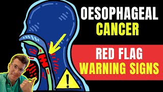 Warning signs amp symptoms of OESOPHAGEALAKA esophageal gullet CANCER  Doctor ODonovan explains [upl. by Lenej]