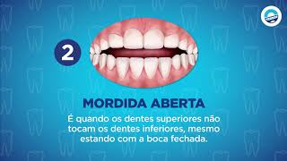 OrthoDontic  Os principais problemas Ortodônticos [upl. by Yrrum]