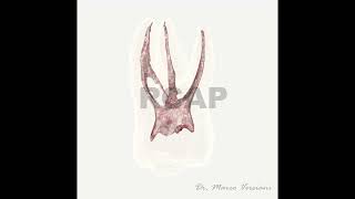 Maxillary First Molar  Prof MarcoVersiani [upl. by Yablon]