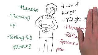 Understanding diabetic gastroparesis [upl. by Ocimad601]