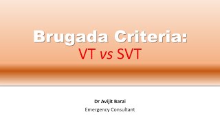 Brugada criteria How to differentiate VT from SVT [upl. by Lore]