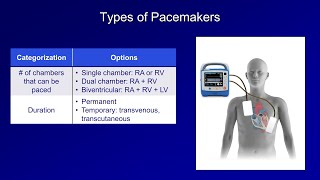 An Introduction to Pacemakers [upl. by Arima]