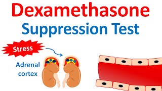 Dexamethasone suppression test DST  Cushings syndrome [upl. by Yzdnil]