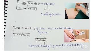 Pinard Fetoscope  Fetal Dopler  Norcet  Image  Based  Mcq [upl. by Ardnasxela414]