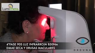 Tratamiento con luz de Degeneración Macular seca asociada a la edad DMAE Lumithera Dr Orduna 2019 [upl. by Nnailuj]