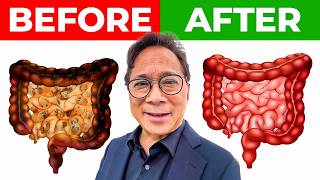 “WAKE UP PEOPLE” The Shocking Benefits of These 20 GUTBoosting Foods  Dr William Li [upl. by Ramu908]