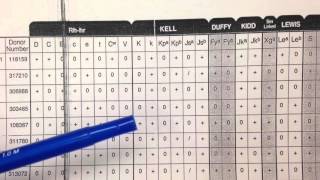 Blood Bank Antibody Panel Overview [upl. by Abrahan]