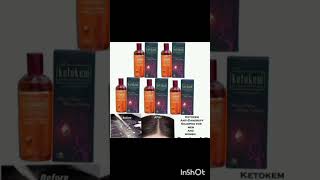 Ketokem Anti Dandruff shampoo reviewglamorousbeautygate short [upl. by Assille]