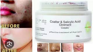 Cosalic Ointment Coaltar amp Salicylic Acid Ointment [upl. by Notslar]