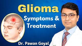 Glioma Symptoms amp Treatment  Dr Pawan Goyal [upl. by Nnateragram250]