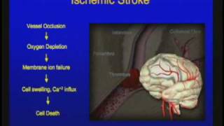 Vascular Disorders of the Central Nervous System [upl. by Nylg]