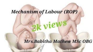 Mechanism of labourright occipito posterior by babitha mathew [upl. by Kopans]