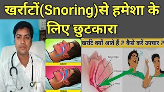 खर्राटे ।। Snoring । best homeopathic medicine for Snoring।। Snoring ka Homeopathic Treatment [upl. by Bronwen]