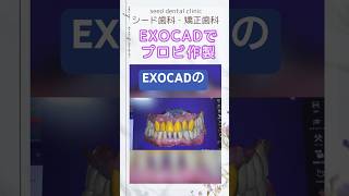 EXOCADを使用してプロビ作製しました🥰🥰💕 [upl. by Manvell883]