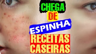 5 RECEITAS CASEIRAS para ACABAR com as ESPINHAS em minutos [upl. by Andriana788]