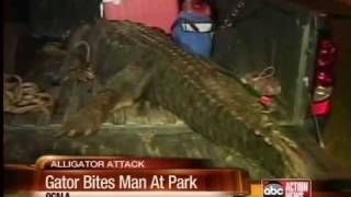 Gator attacks UF researcher [upl. by Gnurt102]