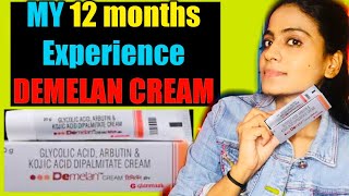 MY 12 MONTHS EXPERIENCE WITH DEMELAN CREAM  DEMELAN CREAM  DEMELAN  DEMELAN CREAM REVIEW  HEENA [upl. by Janie]