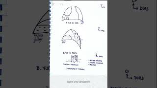 Épanchement pleural et ponction pleurale [upl. by Anes702]