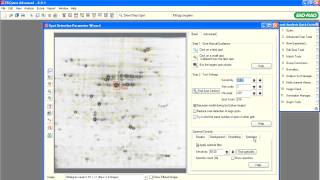 PDQuest™ Software Tutorials — Optimize Spot Detection [upl. by Asaph]