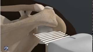 How To Shoulder Glenohumeral Joint 3D Video [upl. by Lubin13]