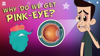 What Causes Conjunctivitis  CONJUNCTIVITIS  PinkEye  The Dr Binocs Show  Peekaboo Kidz [upl. by Nyliram806]