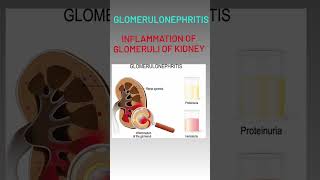 Disorders of Excretory Systemanatomy ytshorts mbbs neet2024 education yt20 viralvideo [upl. by Adnir]