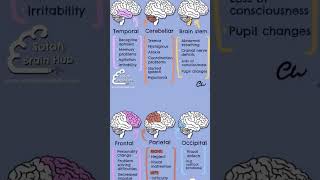 Brain Lobes brain anatomy science [upl. by Allerus691]