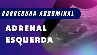 Técnica de varredura adrenal esquerda [upl. by Onavlis]