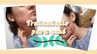 ¿Tratamiento para el acné ¿me funcionó ¿minociclina Parte 2💖  acne [upl. by Odlavso]