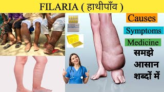 Filaria Causes Filaria Symptoms  Filaria Treatment  Nursing Notes  Elephantiasis हाथीपाँव [upl. by Zicarelli]