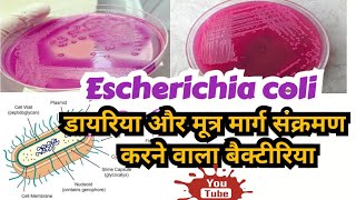 Escherichia coli pathogenesis clinical manifestations and lab diagnosis in hindi [upl. by Naujud]