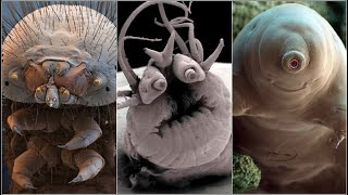 Incredible Electron Microscope Images [upl. by Nadabas7]