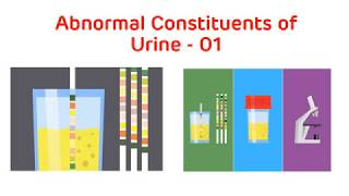 Analysis of Abnormal Urine  Abnormal Urine Constituents Practical Part I  Biochemistry Practical [upl. by Bodnar]