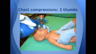 Resuscitation of Newborn Infants [upl. by Ical]