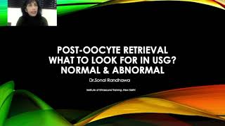 Post oocyte retrieval What to look for in USG [upl. by Anitan850]