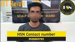 HSN Hair Transplant result 6 months completed result review in kannada  hsn fue hair [upl. by Talanian]