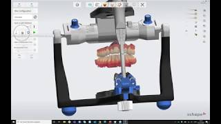 Webinar 3Shape Splint Studio German [upl. by Ahsoyem]