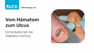 Diabetischer Fuß  vom Hämatom zum Ulcus  Fallbeispiel [upl. by Lavina]