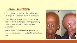 Lecture146 Genetic disorders of Collagen Elastin and Dermal matrix Part II [upl. by Ver]