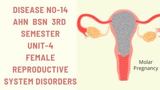 Hydatidiform MoleMolar pregnencyDisease14AHNBSN 3rdsemester Unit4female reproductive disorders [upl. by Rosemary]