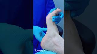 Podología Podólogo Podóloga Tratamiento Fasciitis plantar Pedicura Pedicure Barefoot Pies descalzos [upl. by Ahsrats185]