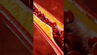 Plaque in arteries Atherosclerosis heartdisease stroke heartattack 3danimation [upl. by Dennet250]