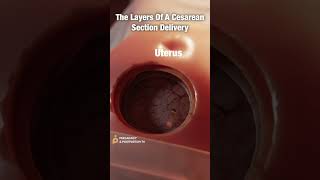 Layers of CSection Delivery ✨FASCINATING✨ shorts [upl. by Gordy]