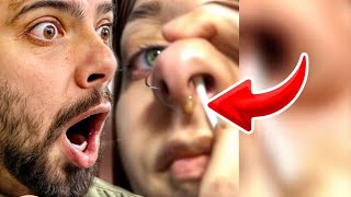 Popping huge blackheads and Giant Pimples Best Pimple Popping Videos [upl. by Eniar]