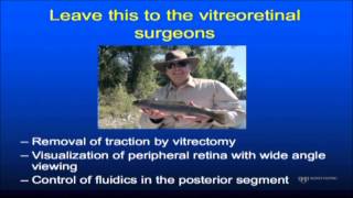 Mayo Clinic Ophthalmology Retina Update and Case Conference Vitreoretinal  Dr Bakri [upl. by Ayatal]