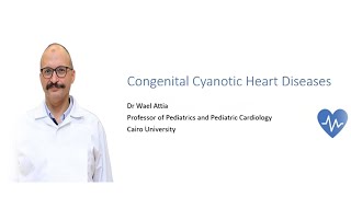 Congenital Cyanotic Heart Diseases Prof Wael Attia Prof of Pediatric Cardiology Cairo University [upl. by Alameda]