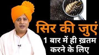 सर की जुएं 1 बार में ही ख़तम Get Rid OF Head Lice Home Remedy  Sanyasi Ayurveda [upl. by Calloway]