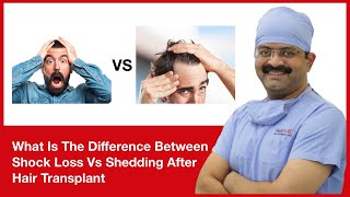 What Is The Difference Between Shock Loss Vs Shedding After Hair Transplant  In HINDI [upl. by Lienhard601]